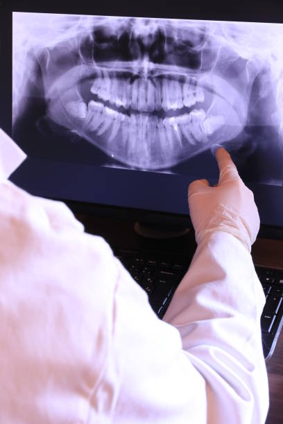 Best Emergency Tooth Extraction in Uvalde Estates, TX